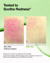 Azelaic Acid 10+ Hyaluron Redness Soothing Serum
