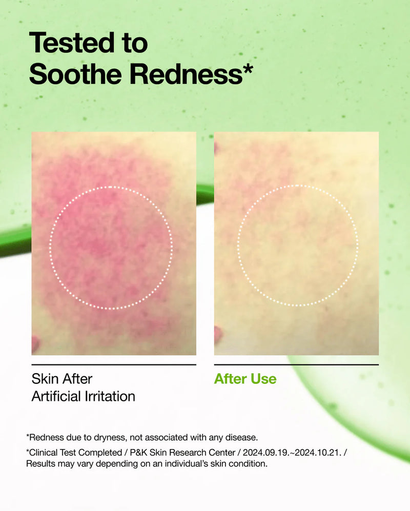 Azelaic Acid 10+ Hyaluron Redness Soothing Serum